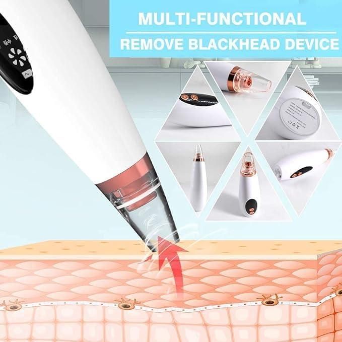 6-in-1 Multi-Function Blackhead Remover Kit – Professional Pimple & Acne Extractor Tools