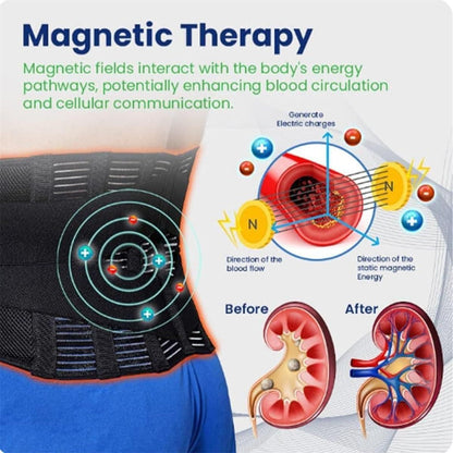 Acupressure Kidney Care Belt – Support & Pain Relief for Kidney and Lower Back