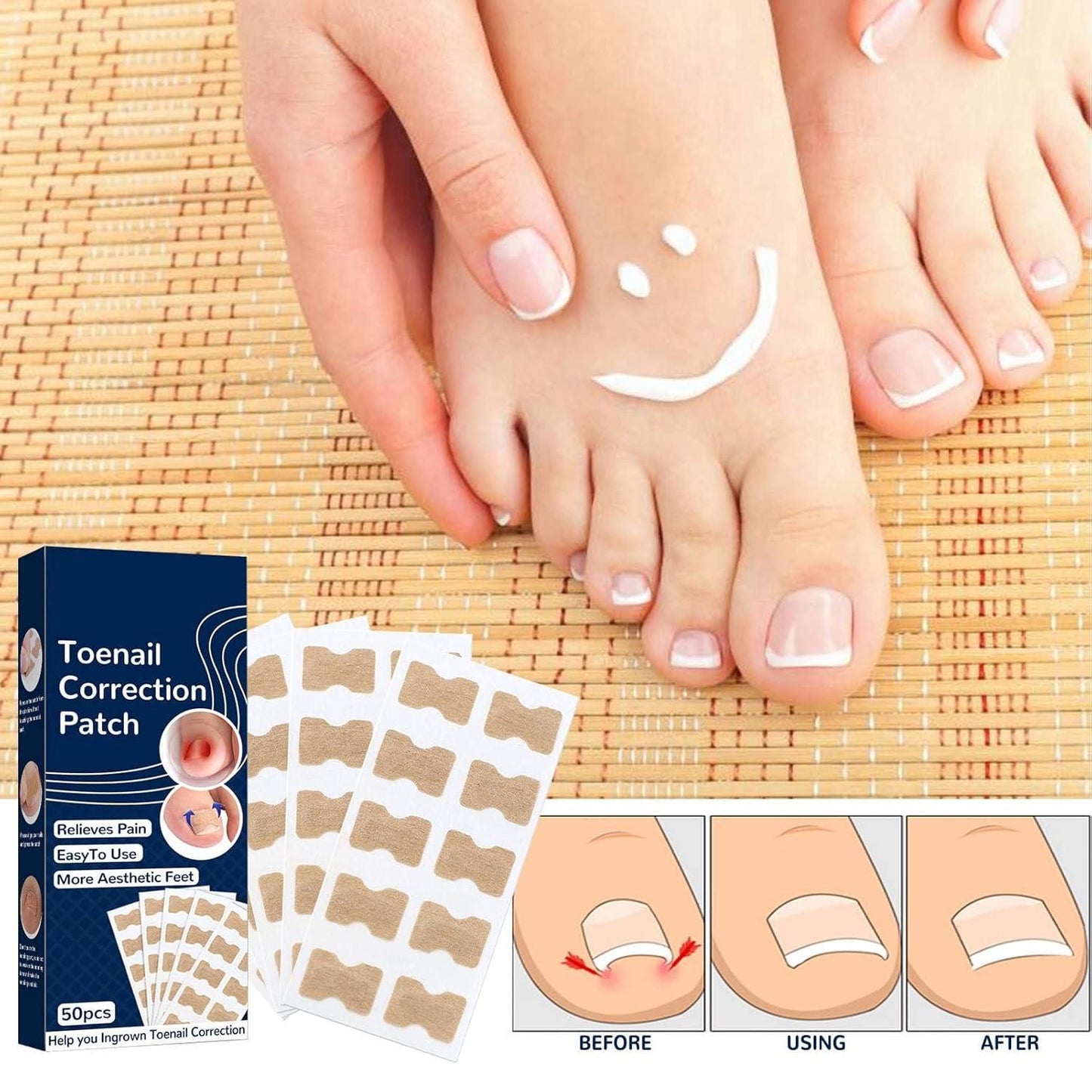 Ingrown Toenail Corrector Stickers – Pain Relief & Nail Correction Strips